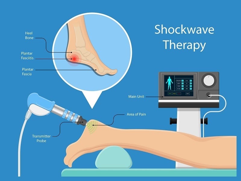 Can Shockwave Therapy help me?