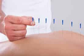 What health conditions can Acupuncture treat?