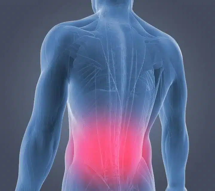 Should you see a chiropractor for lower back pain?